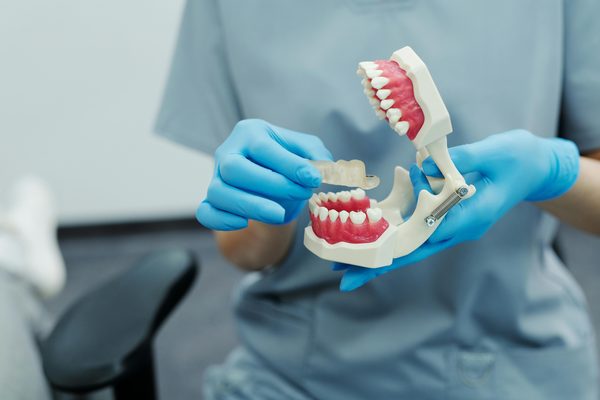 Orthodontie adulte à Nanterre : Dr Soheili vous aide à sourire mieux